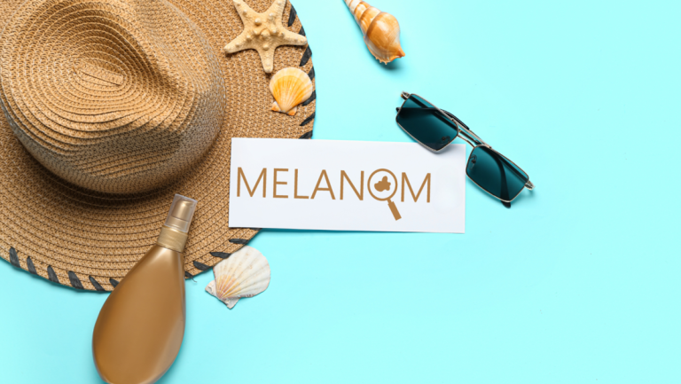 Melanom – tamna strana preplanule kože