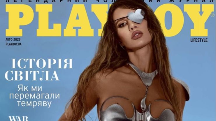 Ostala bez oka: Supruga ukrajinskog političara osvanula na naslovnici “Playboya”