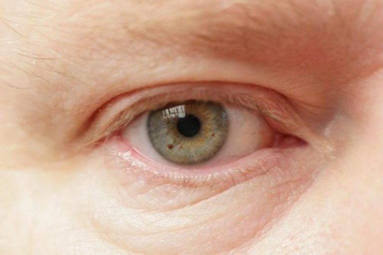 Oftalmolozi otkrili koja navika najviše šteti zdravlju očiju