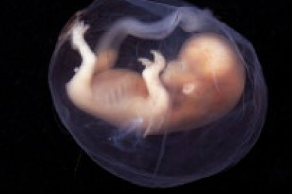Pakistan: Nerođeni fetus bliznakinje živio kao parazit u bebinom stomaku