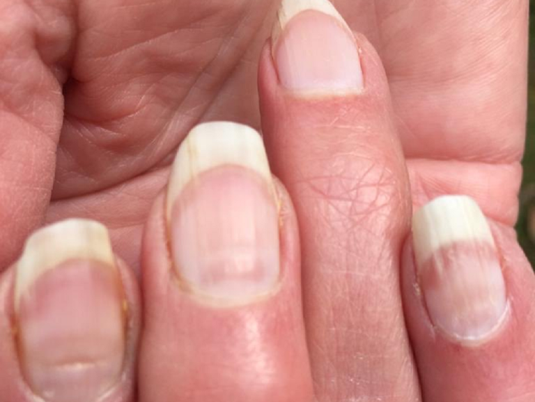 Tri navike koje uništavaju vaše nokte