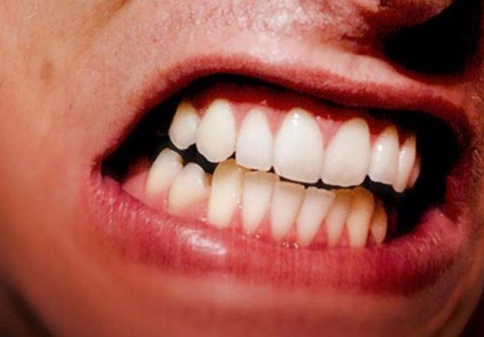 Prestanite s ovim navikama da biste što duže očuvali zube zdravima